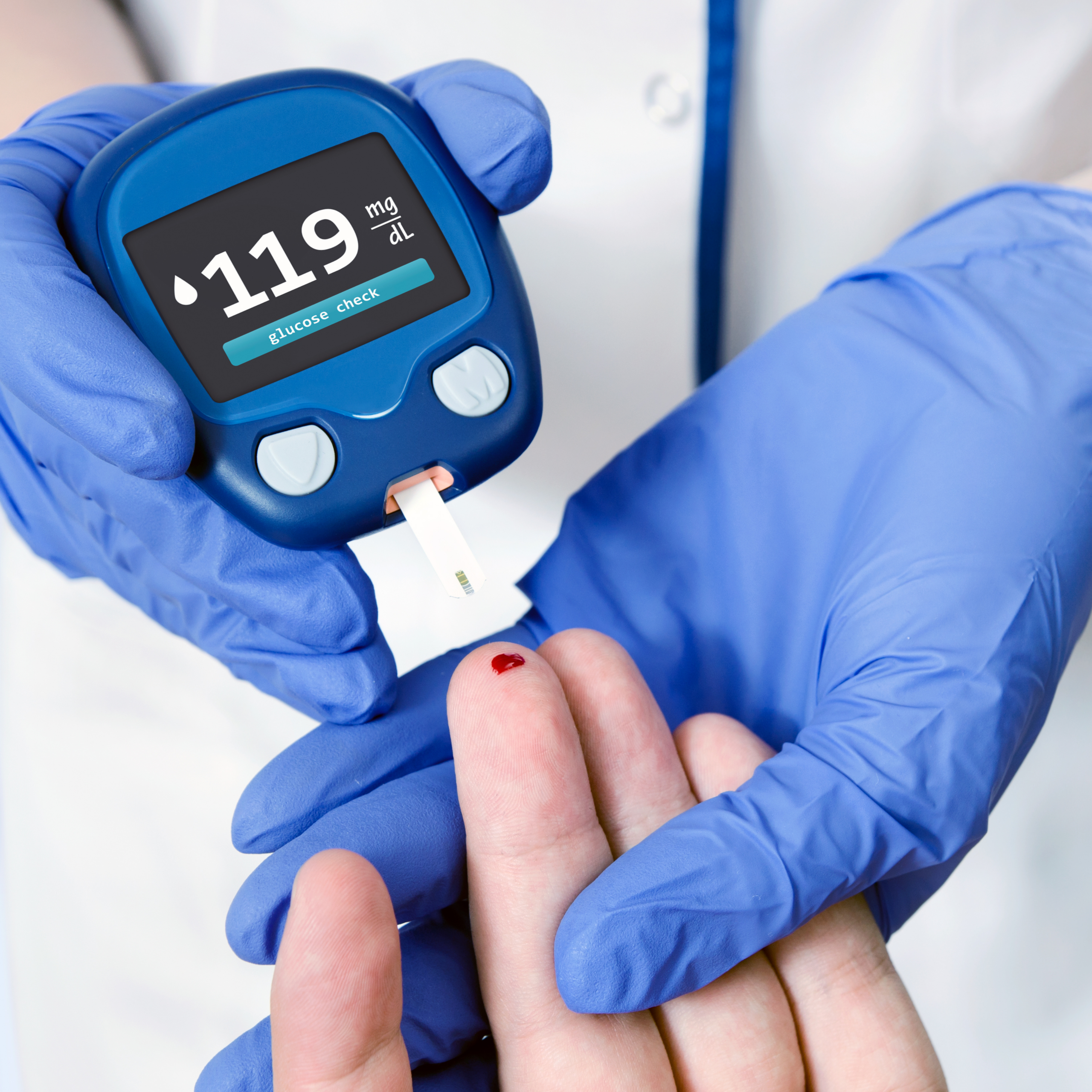 Diabetes Doctor in Madurai